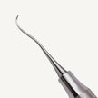 Nevi 1 Anterior