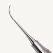 Nevi 3 Posterior